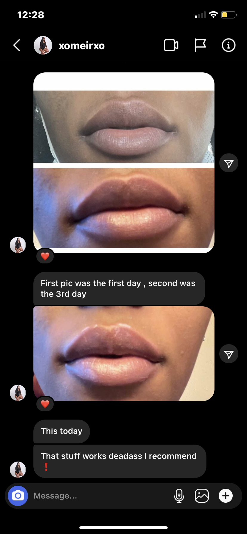 Kazaamy (Discolored lip corrector)