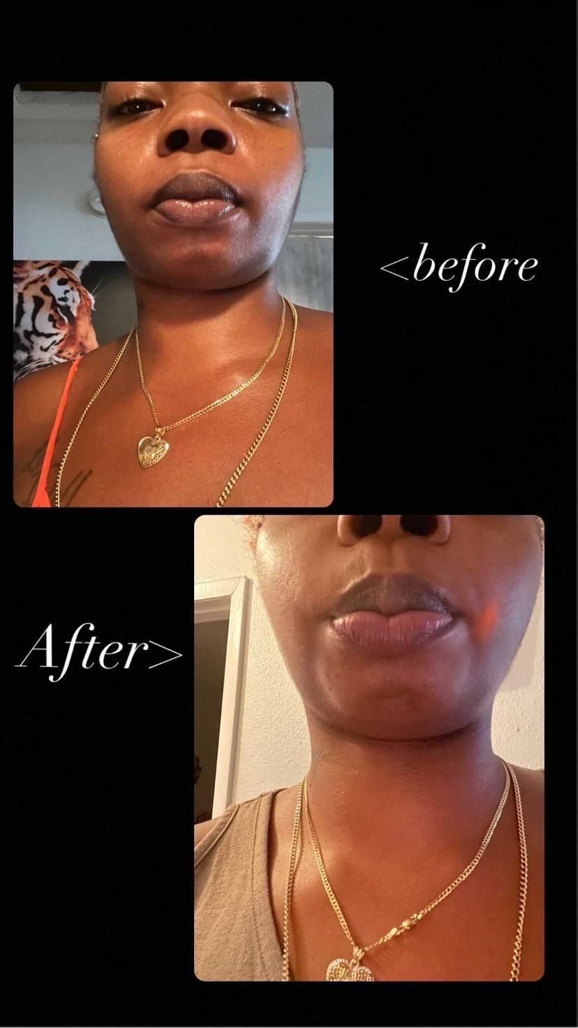 Kazaamy (Discolored lip corrector)