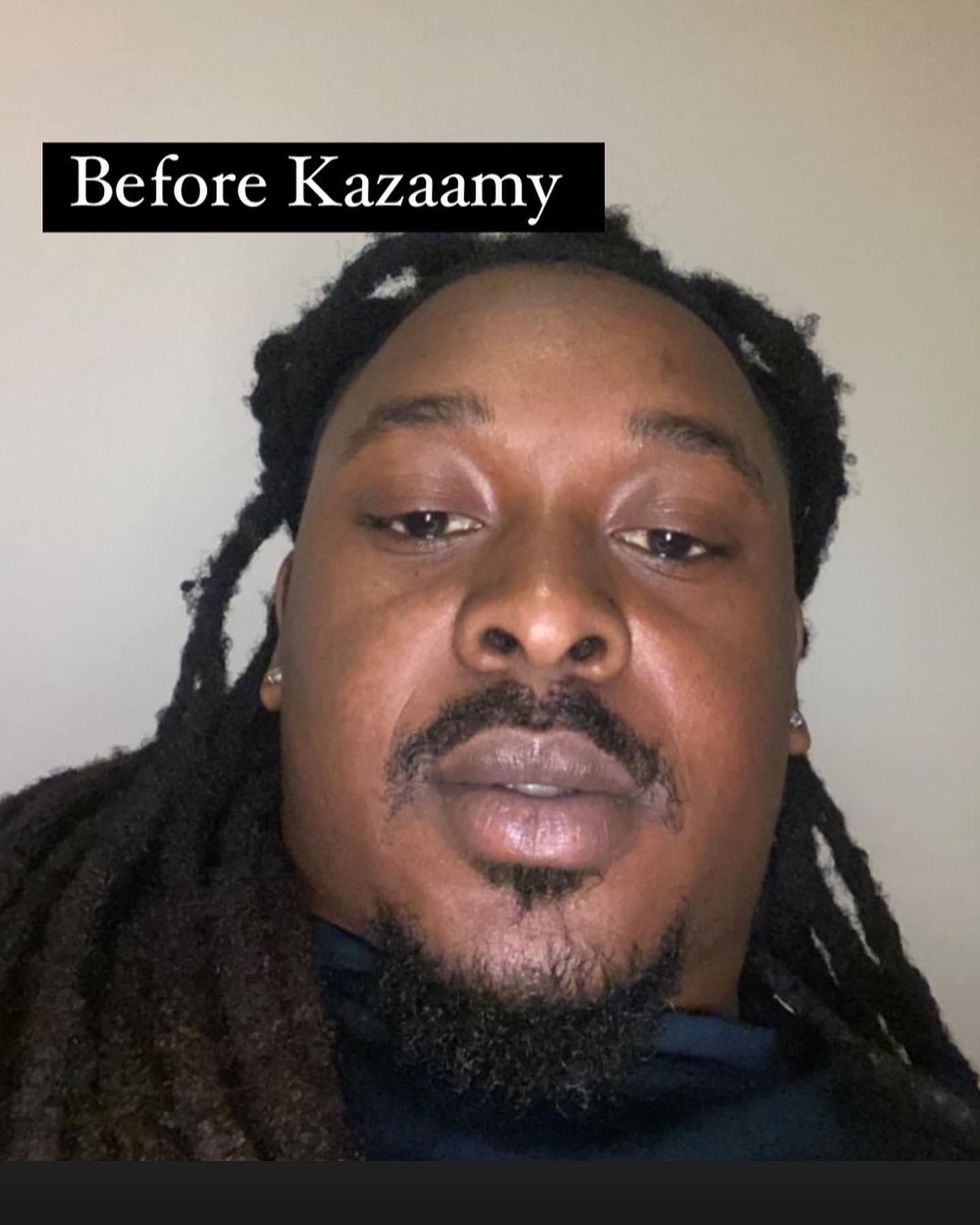 Kazaamy (Discolored lip corrector)